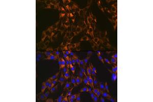 Immunofluorescence analysis of C6 cells using PUMA Rabbit mAb (ABIN1678790, ABIN3018050, ABIN3018051 and ABIN7101572) at dilution of 1:100 (40x lens). (PUMA Antikörper)