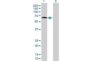 Western Blot analysis of IFNAR1 expression in transfected 293T cell line by IFNAR1 MaxPab polyclonal antibody. (IFNAR1 Antikörper  (AA 1-557))