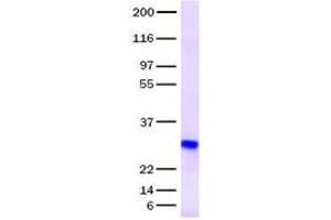 Validation with Western Blot (IGFBP6 Protein)