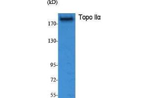 Western Blotting (WB) image for anti-Topo IIalpha (Tyr177) antibody (ABIN6280970) (Topo IIalpha (Tyr177) Antikörper)