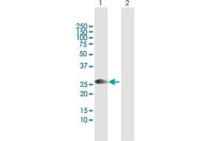 Western Blot analysis of ORC6L expression in transfected 293T cell line by ORC6L MaxPab polyclonal antibody. (ORC6 Antikörper  (AA 1-252))