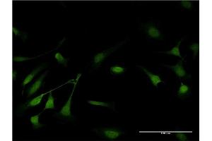 Immunofluorescence of monoclonal antibody to GSTP1 on HeLa cell. (GSTP1 Antikörper  (AA 1-210))