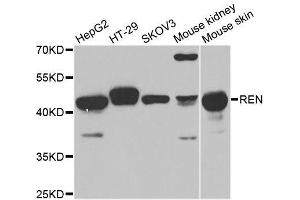 Western blot analysis of extracts of various cell lines, using REN antibody. (Renin Antikörper  (AA 24-160))