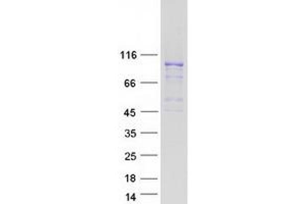 MCM4 Protein (Transcript Variant 2) (Myc-DYKDDDDK Tag)