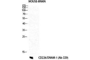 Western Blot (WB) analysis of Mouse Brain cells using DNAM-1 Polyclonal Antibody. (CD226 Antikörper  (Tyr570))