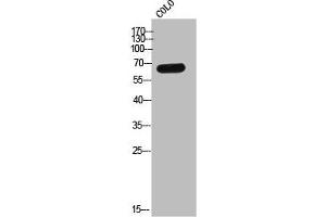 Western Blot analysis of COLO cells using Eme1 Polyclonal Antibody (Crossover junction endonuclease EME1 (EME1) (Internal Region) Antikörper)