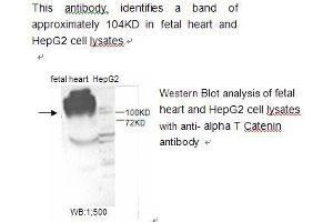 Image no. 1 for anti-Catenin (Cadherin-Associated Protein), alpha 1, 102kDa (CTNNA1) antibody (ABIN790787) (CTNNA1 Antikörper)