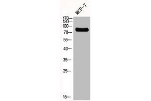 Western Blot analysis of MCF7 cells using GIT2 Polyclonal Antibody (GIT2 Antikörper  (Internal Region))