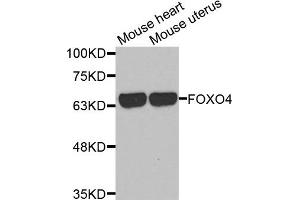 Western Blotting (WB) image for anti-Forkhead Box O4 (FOXO4) antibody (ABIN1872735) (FOXO4 Antikörper)