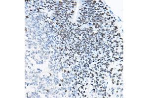 Immunohistochemistry of paraffin-embedded mouse fetal Brain using SOX2 Rabbit pAb (ABIN6130648, ABIN6148295, ABIN6148297 and ABIN6215241) at dilution of 1:100 (40x lens). (SOX2 Antikörper  (AA 1-140))