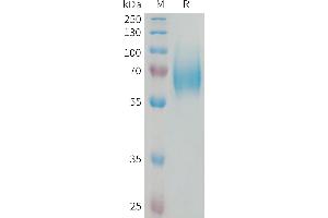 Human F Protein, His Tag on SDS-PAGE under reducing condition. (FGFR1 Protein (AA 22-376) (His tag))