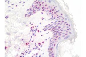 Human Skin: Formalin-Fixed, Paraffin-Embedded (FFPE) (Histone H4 Antikörper)