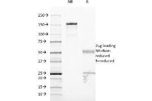 SDS-PAGE Analysis Purified CD54 Monoclonal Antibody (W-CAM-1). (ICAM1 Antikörper)