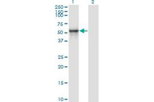 Western Blot analysis of ITFG2 expression in transfected 293T cell line by MDS028 monoclonal antibody (M01), clone 1A8. (ITFG2 Antikörper  (AA 1-447))