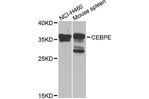Western blot analysis of extracts of various cell lines, using CEBPE antibody (ABIN5975692) at 1/1000 dilution. (CEBPE Antikörper)