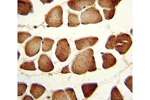 IHC analysis of FFPE human skeletal muscle stained with NAMPT antibody (NAMPT Antikörper  (AA 400-426))