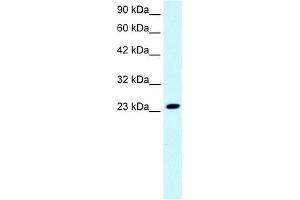 WB Suggested Anti-FLJ11730 Antibody Titration: 0. (FLJ11730 (N-Term) Antikörper)