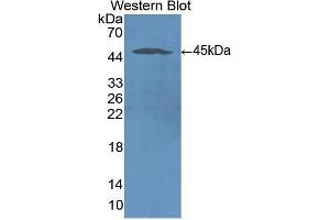 Western Blotting (WB) image for anti-Intercellular Adhesion Molecule 1 (ICAM1) (AA 41-464) antibody (ABIN3201428) (ICAM1 Antikörper  (AA 41-464))