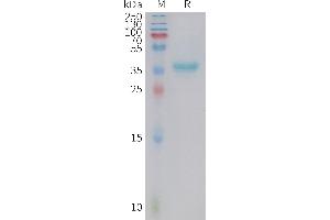 Human GAL Protein, hFc Tag on SDS-PAGE under reducing condition. (GAL Protein (AA 20-123) (Fc Tag))