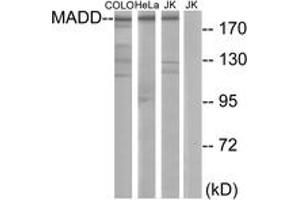 Western Blotting (WB) image for anti-MAP-Kinase Activating Death Domain (MADD) (AA 751-800) antibody (ABIN2889697) (MADD Antikörper  (AA 751-800))