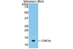 Western Blotting (WB) image for anti-Defensin beta 2 (BD-2) (AA 21-71) antibody (ABIN1858623) (beta 2 Defensin Antikörper  (AA 21-71))