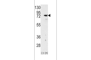 Western blot analysis of PKC delta using rabbit polyclonal PKC delta Antibody using 293 cell lysates (2 ug/lane) either nontransfected (Lane 1) or transiently transfected with the PRKCD gene (Lane 2). (PKC delta Antikörper  (N-Term))