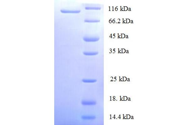 MCM2 Protein (AA 2-904) (His tag)