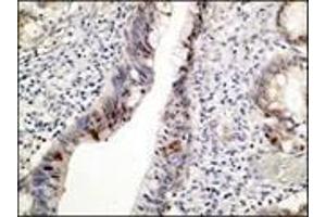 Immunohistochemistry (IHC) image for anti-Tumor Protein P53 (TP53) (C-Term) antibody (ABIN870346) (p53 Antikörper  (C-Term))