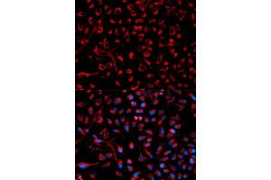 Immunofluorescence analysis of HeLa cells using DOK4 antibody (ABIN5970056). (DOK4 Antikörper)