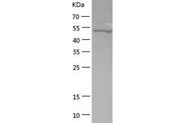 G3BP1 Protein (AA 1-466) (His tag)