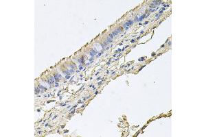 Immunohistochemistry of paraffin-embedded human trachea using EPOR antibody. (EPOR Antikörper)