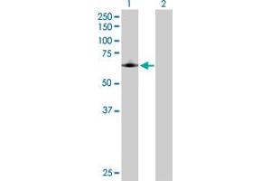 Western Blot analysis of PTGS1 expression in transfected 293T cell line by PTGS1 MaxPab polyclonal antibody. (PTGS1 Antikörper  (AA 1-599))