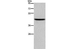 Western Blot analysis of NIH/3T3 cell using TFDP1 Polyclonal Antibody at dilution of 1:650 (DP1 Antikörper)