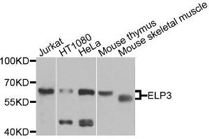 Western blot analysis of extracts of various cell lines, using ELP3 antibody (ABIN6003609) at 1/1000 dilution. (ELP3/KAT9 Antikörper)
