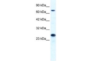 Western Blotting (WB) image for anti-Minichromosome Maintenance Complex Component 6 (MCM6) antibody (ABIN2461394) (MCM6 Antikörper)
