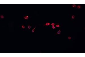 ABIN6266587 staining HeLa  cells by IF/ICC. (MCM5 Antikörper  (N-Term))