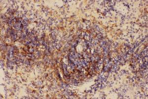 Immunohistochemistry (IHC) image for anti-Intercellular Adhesion Molecule 1 (ICAM1) (AA 198-537) antibody (ABIN3042515)