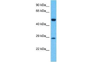 Host:  Rabbit  Target Name:  GLRB  Sample Type:  Fetal Lung lysates  Antibody Dilution:  1. (GLRB Antikörper  (N-Term))