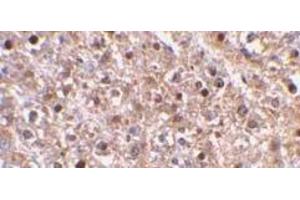 Immunohistochemical staining of Caspase-12 in mouse liver using Caspase-12 antibody at 2μg/ml. (Caspase 12 Antikörper  (AA 100-116))