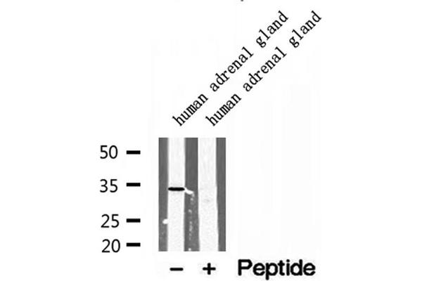 SULT1E1 Antikörper  (Internal Region)