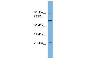 Western Blot showing PPP5C antibody used at a concentration of 1. (PP5 Antikörper  (Middle Region))