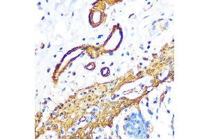 Immunohistochemistry of paraffin-embedded human colon using Filamin A Rabbit mAb (ABIN1682545, ABIN3018024, ABIN3018025 and ABIN7101570) at dilution of 1:100 (40x lens). (Filamin A Antikörper)