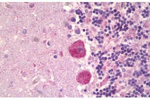 Anti-MAPK15 antibody IHC staining of human brain, cerebellum. (MAPK15 Antikörper  (AA 1-245))