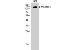 Western Blot analysis of 293T cells with Phospho-FAK (Tyr397) Polyclonal Antibody at dilution of 1:1000 (FAK Antikörper  (pTyr397))