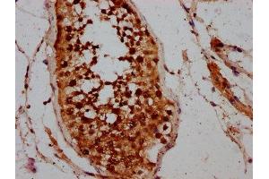 IHC image of ABIN7146463 diluted at 1:200 and staining in paraffin-embedded human testis tissue performed on a Leica BondTM system. (Calicin Antikörper  (AA 240-351))