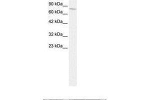Image no. 2 for anti-Endoglin (ENG) (AA 61-110) antibody (ABIN202837) (Endoglin Antikörper  (AA 61-110))