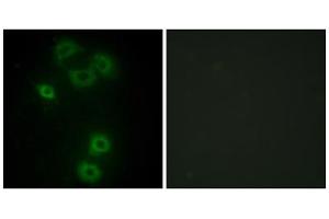 Immunofluorescence analysis of A549 cells, using BMX antibody. (BMX Antikörper  (N-Term))