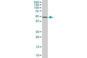 Western Blotting (WB) image for anti-Ets Variant 5 (ETV5) (AA 181-290) antibody (ABIN560808)