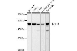 Western blot analysis of extracts of various cell lines, using RNF14 antibody (ABIN7270060) at 1:500 dilution. (RNF14 Antikörper)