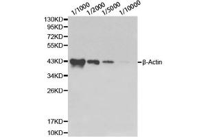 Western blot analysis of HeLa cell using β-actin antibody at different dilutions. (beta Actin Antikörper)